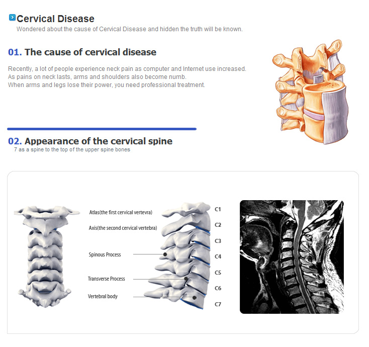 Cervical Disease