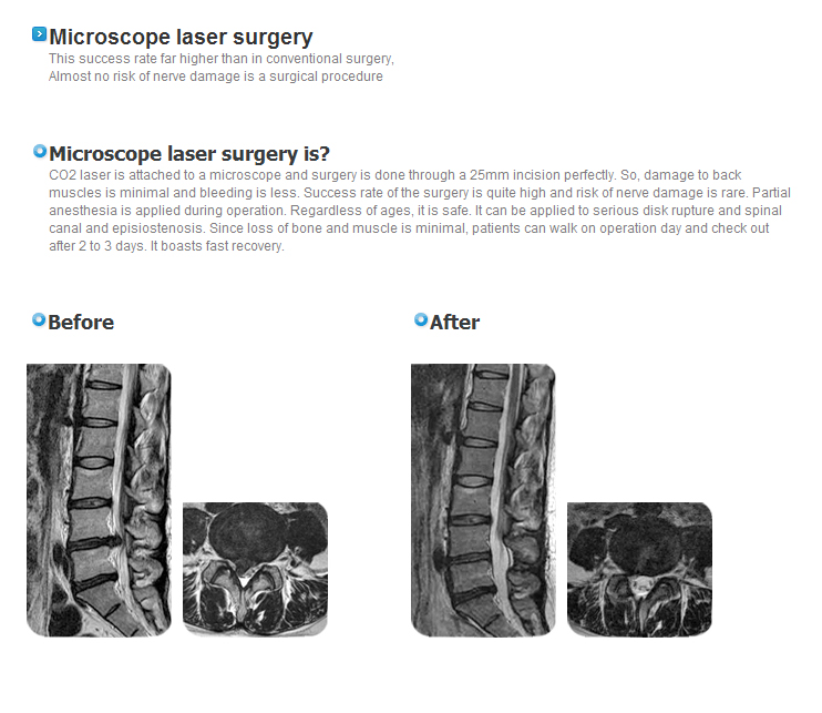 Microscope Iaser surgery